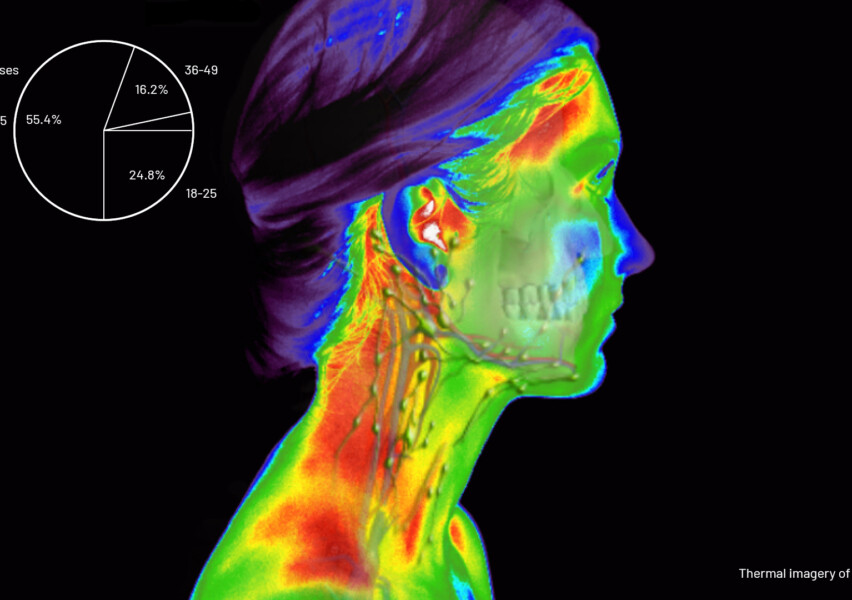 After conducting an online user research survey that spanned thirteen questions, I received 278 individual responses across the 18-49 age groups. The biggest recurring user pain-points were heat, pressure and sweat from prolonged use. As you can see in this thermograph, over-ear headphones cover and compress the natural heat dissipating features on our heads, our ears.